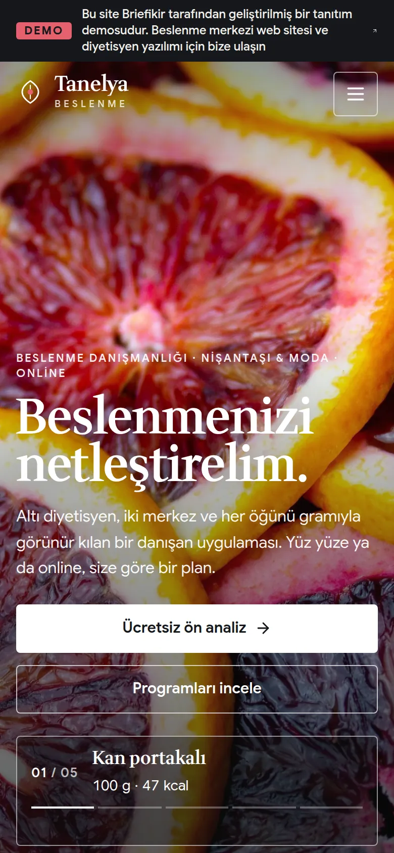 Beslenme Danışmanlığı Merkezi Web Sitesi ve Diyetisyen Yazılımı — Demo — mobil görünüm