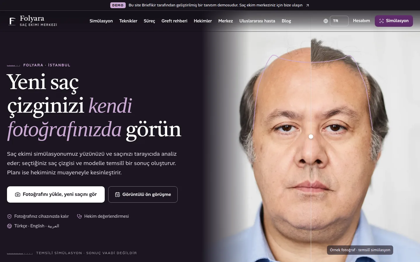 Saç Ekim Merkezi Web Sitesi ve Fotoğraflı Saç Simülasyonu — Demo — masaüstü görünüm