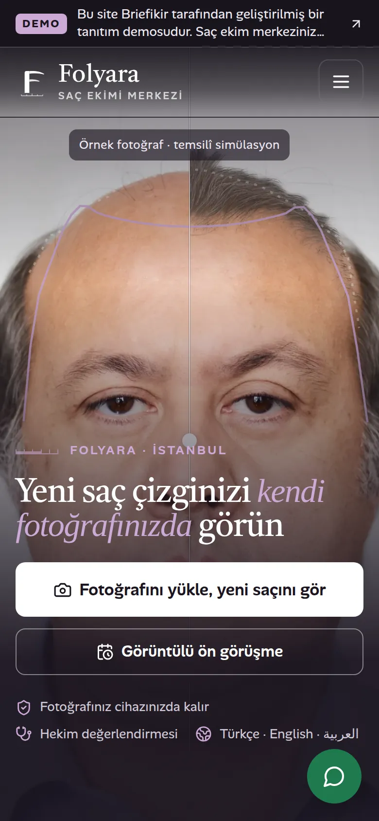 Saç Ekim Merkezi Web Sitesi ve Fotoğraflı Saç Simülasyonu — Demo — mobil görünüm